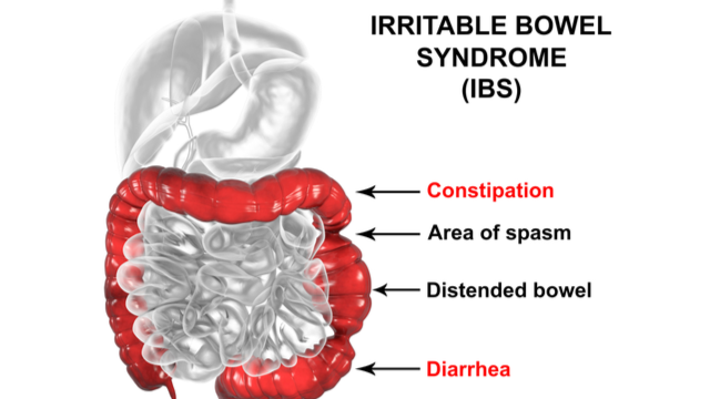 IBS area