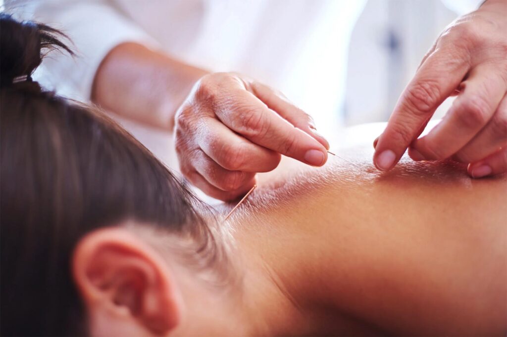 Screenshot Gentle acupuncture needle insertion for pain and stress relief